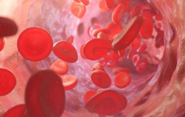 Медики назвали фактор, который увеличивает риск смерти или инсульта