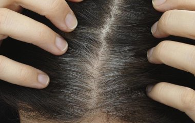 Трихолог назвала способи захиститися від ранньої сивини