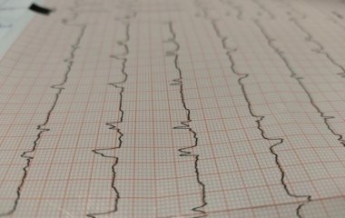 Кардіолог назвала три ознаки швидкого інфаркту