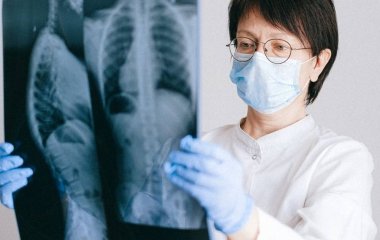 Медики знайшли аномалії в структурі легень у хворих на коронавірус.