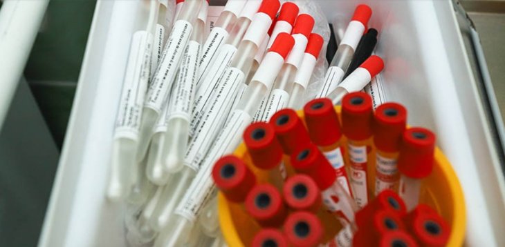 Британські вчені вигадали тест, що виявляє 50 різновидів онкології