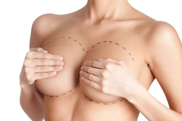 Маммопластика: операции по увеличению груди