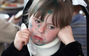 Лікар: повторно на вітрянку захворіти не можна