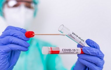 2 нових фактори, що пояснюють смертельну течію коронавірусу