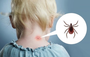 Як захистити свою дитину від укусів кліщів, які можуть заразити її небезпечними інфекціями