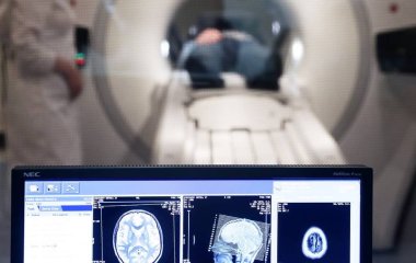 Неуживливість може захищати літній мозок від недоумства