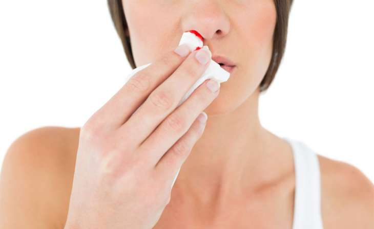 10 причин носового кровотечения