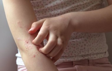 Перенесена в дитинстві вірусна хвороба може викликати гастрит.