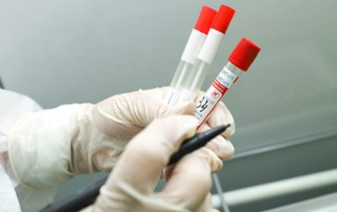 В Африці виявили невразливу до ліків малярію