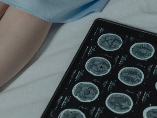 Поїздка до Індії ледь не коштувала життя: у мозку жінки виявили 38 паразитів