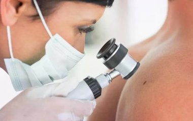 Рак шкіри навчилися лікувати вірусом герпесу.
