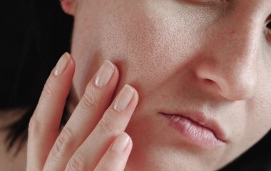 Нутриціолог розповіла, які продукти допоможуть покращити шкіру обличчя