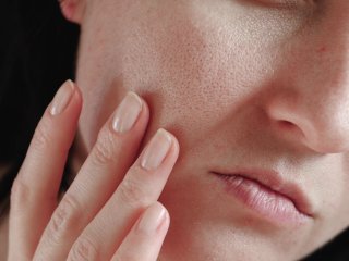 Нутрициолог рассказала, какие продукты помогут улучшить кожу лица