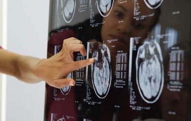 Вчені назвали причину зниження активності мозку та старіння