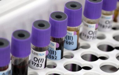 Лікарі навчилися визначати депресію щодо аналізу крові