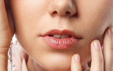 Медики объяснили, в чем опасность потрескавшихся губ