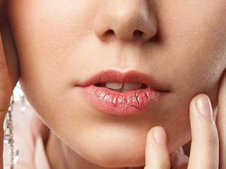 Медики объяснили, в чем опасность потрескавшихся губ