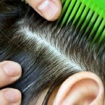 Почему возникает перхоть и как ее побороть: ответ специалистов