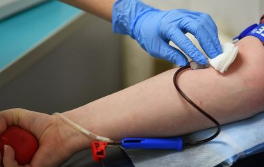 Лікар перерахував ознаки підвищення рівня холестерину у крові