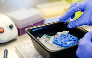 Вчені отримали наночастки для покращення діагностики інфаркту та раку