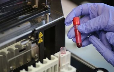 Мікробний склад крові вказує на рак, виявили вчені