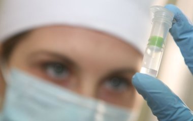 Лікар назвав розлад, який може розвинутися у людей, що перехворіли на коронавірус.