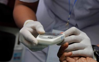 Лікар розповів про небезпеку підвищення холестерину в крові