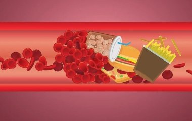 Як знизити холестерин в домашніх умовах: як покращити самопочуття без ліків