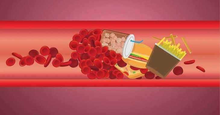 Як знизити холестерин в домашніх умовах: як покращити самопочуття без ліків