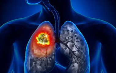 Названа дієта, яка може відновити легені курця