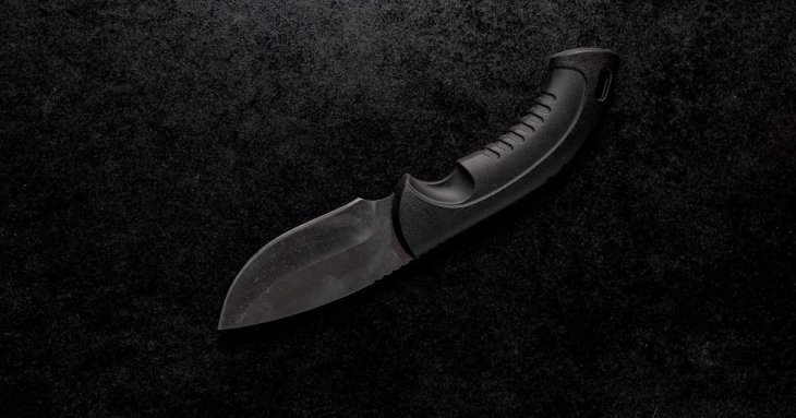 Сором'язливий чоловік відрізав 4 пальці замість того, щоб сказати босу, що хоче звільнитися – фото