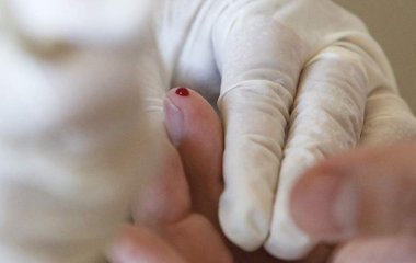 Лікар розповіла про зв'язок групи крові із ризиком розвитку діабету