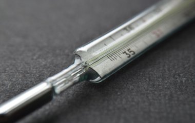 Термометр застряг у сідниці жінки на 22 роки — фото