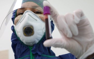 Скільки потрібно антитіл і чому їх важливо перевірити перед щепленням: поради доктора наук