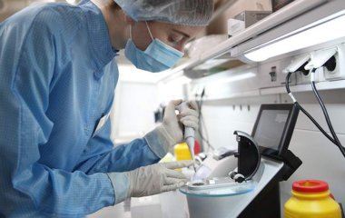 Вчені знайшли спосіб знизити ризик інсульту при генетичній схильності