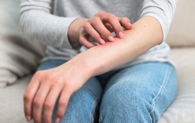 Свербіж шкіри без висипу: яка небезпека приховується за симптомами