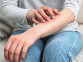 Свербіж шкіри без висипу: яка небезпека приховується за симптомами