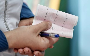 Названо несподіваний продукт, що знижує ризик інфаркту