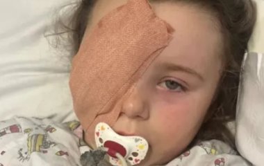 7-річна дівчинка втратила око через вейп: що сталося (фото)