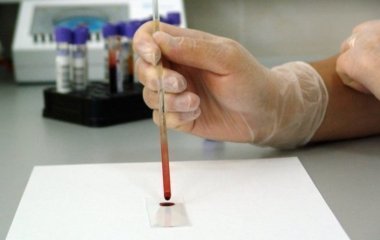 Який тест на ковід і коли використовувати в епоху омікрону?
