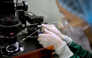 Біологи відкрили білок, що захищає мозок від появи хвороби Альцгеймера