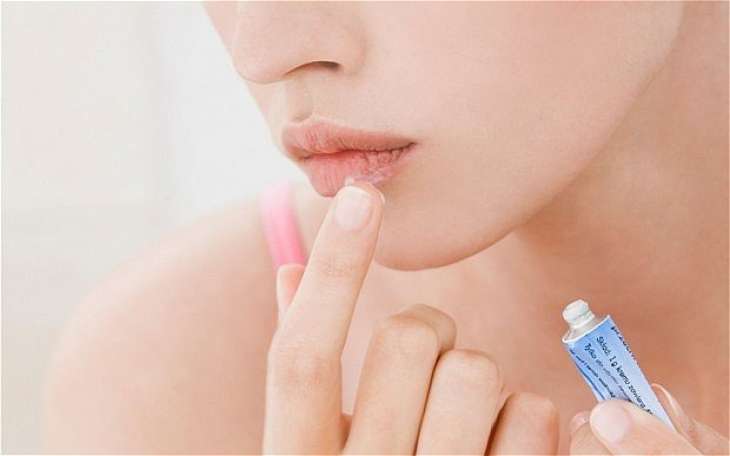 Простуда на губах: помощь, от которой зависит ваш внешний вид