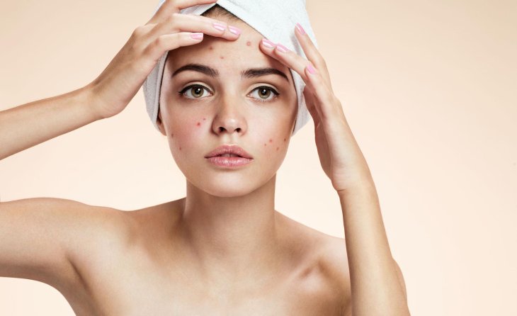 Как бороться с beauty-проблемами во время критических дней