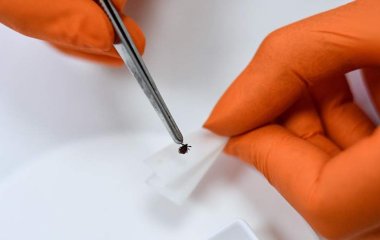 Лікар розповіла про порядок дій при укусі кліща
