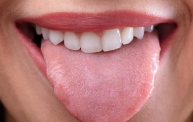 П'ять симптомів мовою, які лікарі радять ніколи не ігнорувати