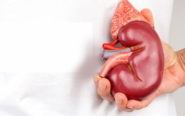 Уролог розвіяв 3 міфи про причини появи каменів у нирках