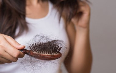 Які продукти та напої сприяють випадінню волосся: дослідники пояснили