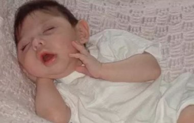 Жінка, яка народилася без мозку, відсвяткувала 20-річчя — фото