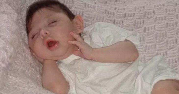 Жінка, яка народилася без мозку, відсвяткувала 20-річчя — фото