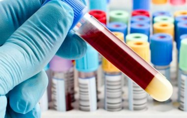 Чому перед вакцинацією потрібний аналіз крові? Пояснює лікар імунолог